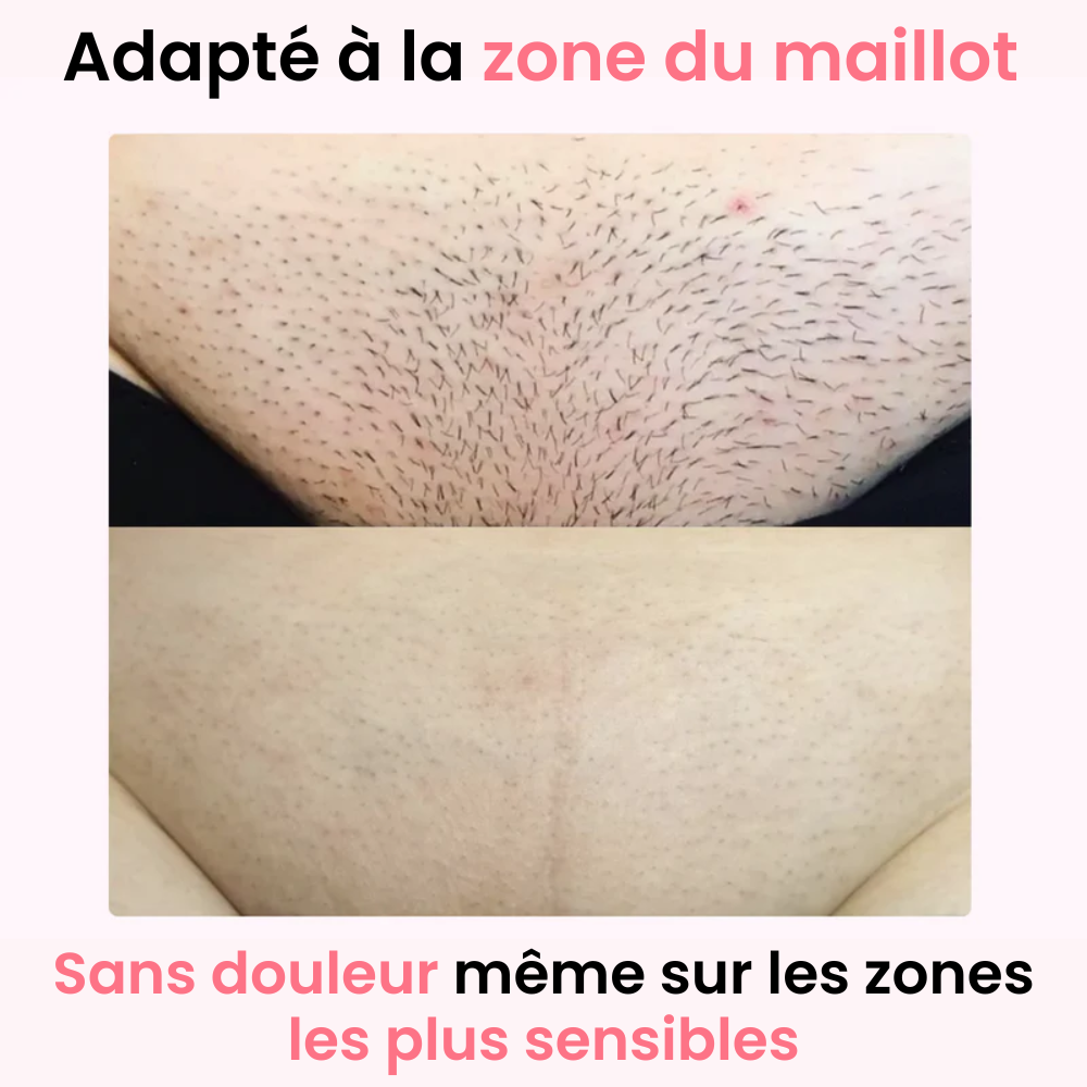 Épilateur à Lumière pulsée IPL Ulvessa Lite