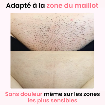 Épilateur à Lumière pulsée IPL - Ulvessa