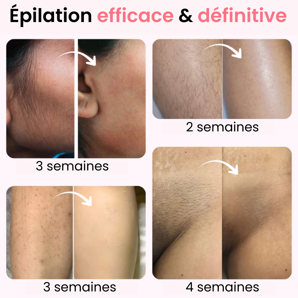 Épilateur à Lumière pulsée IPL Ulvessa Lite