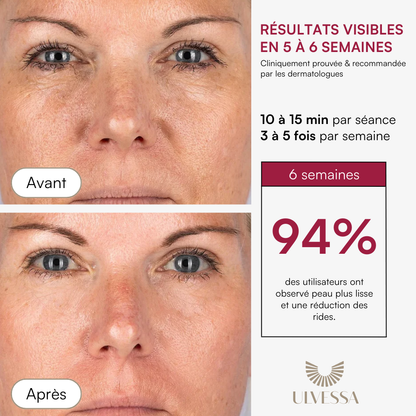 Masque LED Visage Luminothérapie - ULVESSA Série 2