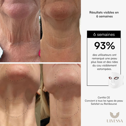 Masque LED Visage Luminothérapie - ULVESSA Série 2